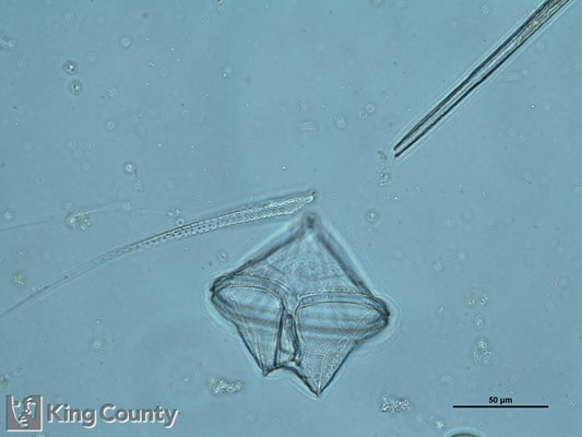 Photo of Protoperidinium conicum/Protoperidinium leonis